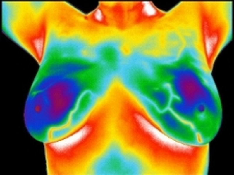 What Makes ThermaVUE® Medical Thermal Imaging So Unique?