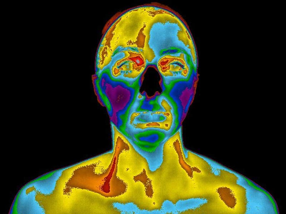 Body Imaging ThermaVUE